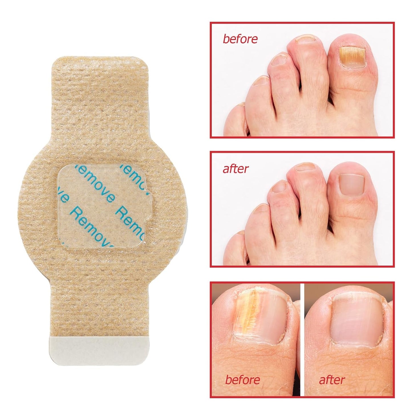 CL™ Overnight Repair Nail Patches (21-Pack)