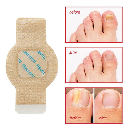 CL™ Overnight Repair Nail Patches (21-Pack)